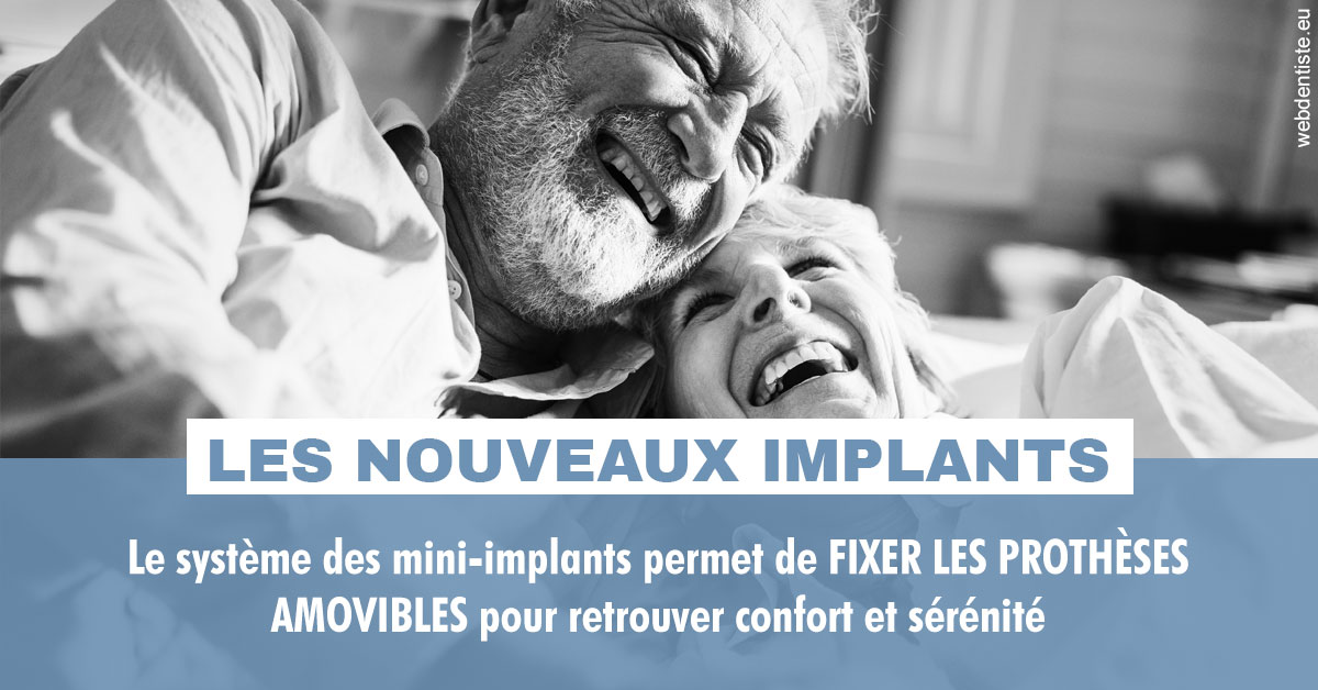 https://dr-didier-szwarc.chirurgiens-dentistes.fr/Les nouveaux implants 2