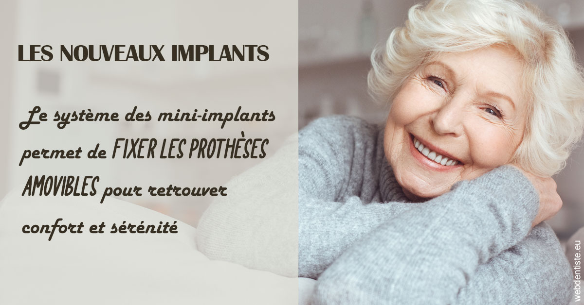 https://dr-didier-szwarc.chirurgiens-dentistes.fr/Les nouveaux implants 1