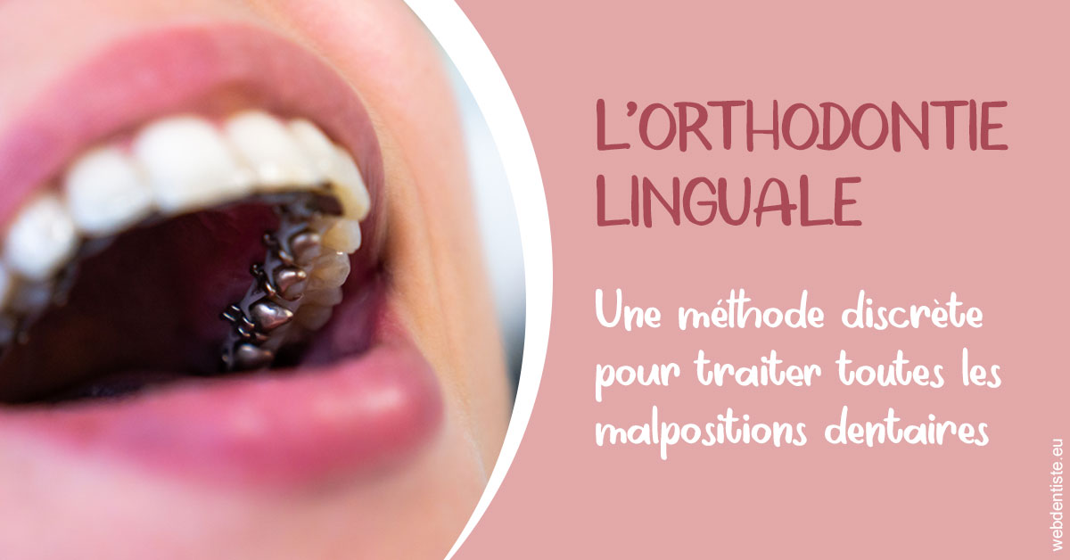 https://dr-didier-szwarc.chirurgiens-dentistes.fr/L'orthodontie linguale 2