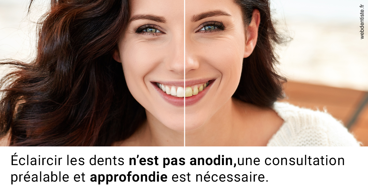 https://dr-didier-szwarc.chirurgiens-dentistes.fr/Le blanchiment 2