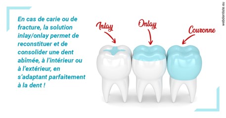 https://dr-didier-szwarc.chirurgiens-dentistes.fr/L'INLAY ou l'ONLAY