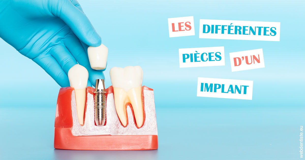 https://dr-didier-szwarc.chirurgiens-dentistes.fr/Les différentes pièces d’un implant 2