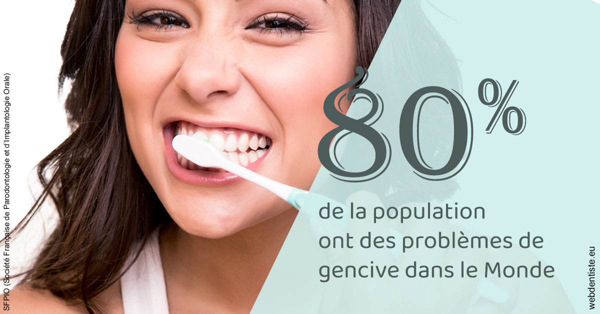 https://dr-didier-szwarc.chirurgiens-dentistes.fr/Problèmes de gencive 1