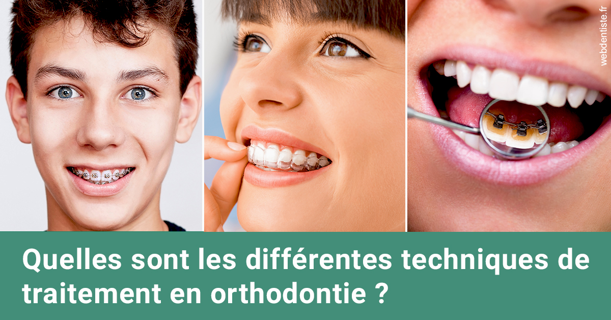 https://dr-didier-szwarc.chirurgiens-dentistes.fr/Les différentes techniques de traitement 2