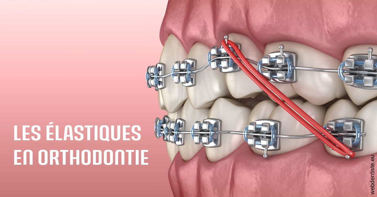 https://dr-didier-szwarc.chirurgiens-dentistes.fr/Elastiques orthodontie 2