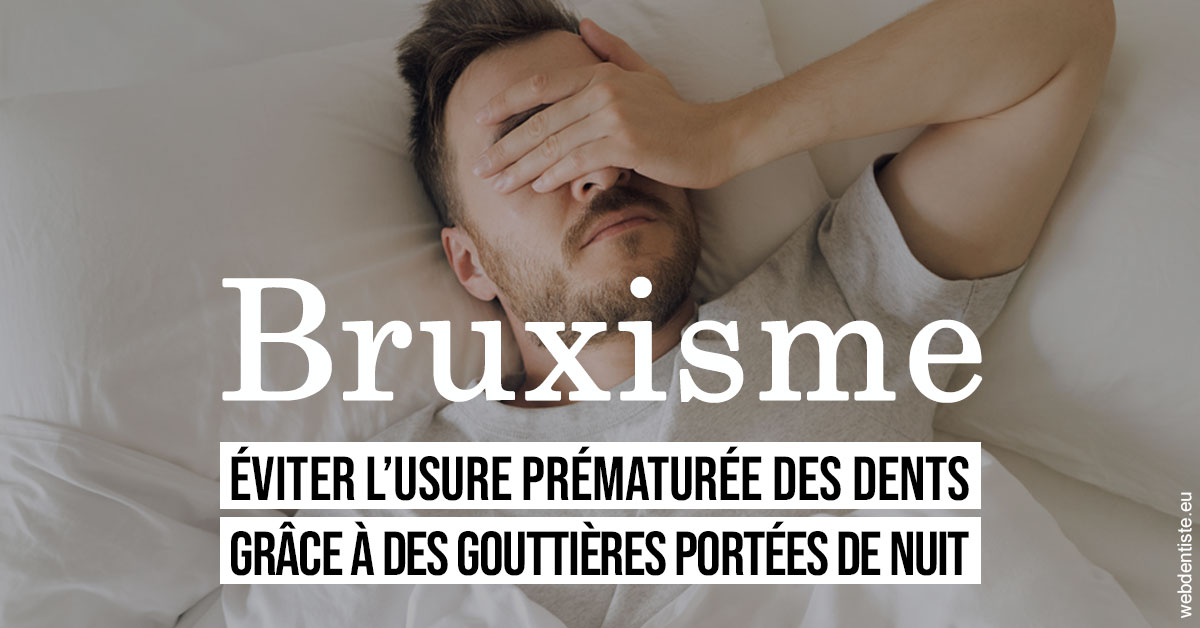 https://dr-didier-szwarc.chirurgiens-dentistes.fr/Bruxisme 1