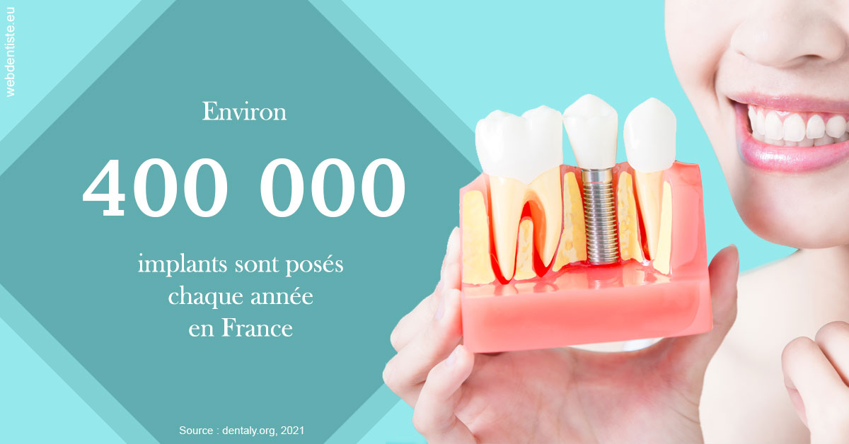 https://dr-didier-szwarc.chirurgiens-dentistes.fr/Pose d'implants en France 2