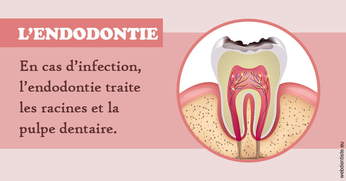 https://dr-didier-szwarc.chirurgiens-dentistes.fr/L'endodontie 2